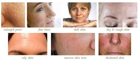 Skin Texture Improvement