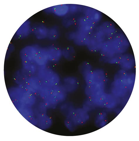 Cytocell Egfr Amplification Fish Probe Ogt