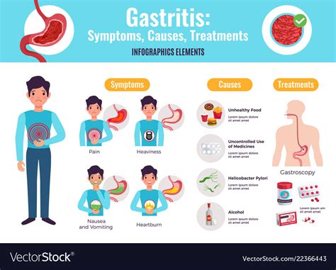 Gastritis Infographic Poster Royalty Free Vector Image