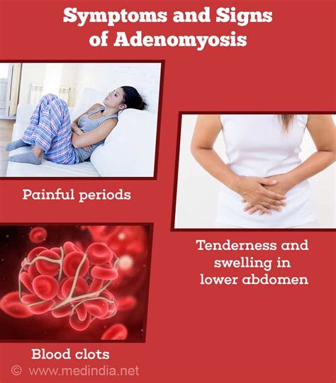 Adenomyosis Bulky Uterus Causes Symptoms Diagnosis Treatment