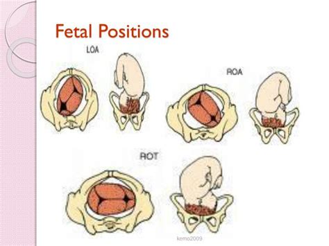 Fetal Positions Chart