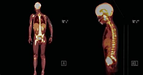 Full Body Ct Scans What You Need To Know Omega Pds
