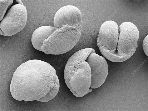 Scots Pine Pollen Grains Sem Stock Image C0382234 Science Photo