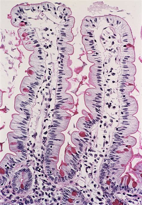 Small Intestine Lining Photograph By Cnri Science Photo Library Fine