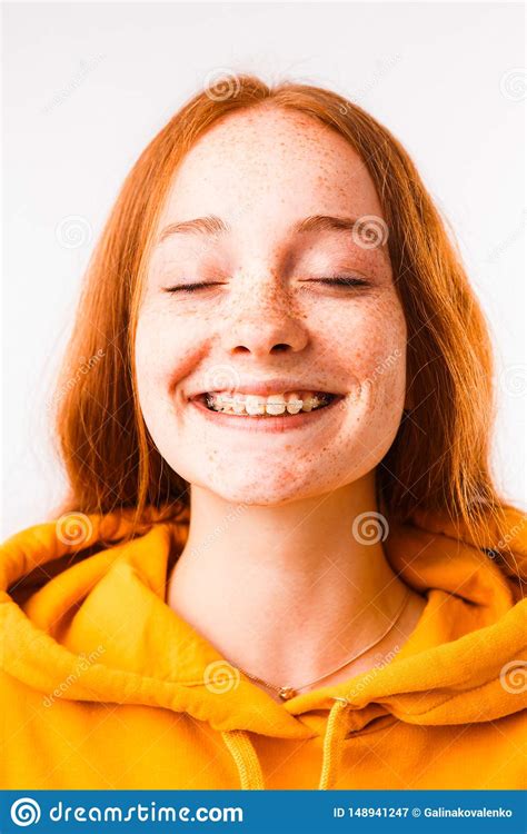 Portrait Of An Emotional Red Haired Girl With Freckles And Braces On A