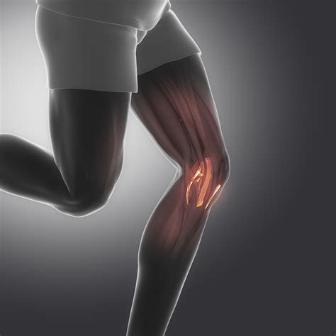 Pcl Injury Questions Answered Facty Health