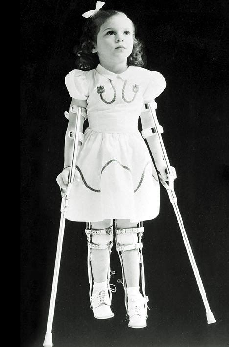 Pin On Paraplegic Spina Bifida Polio Girls In Full Leg Braces