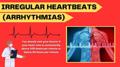 why irregular heart beats is still important arrhythmias youtube