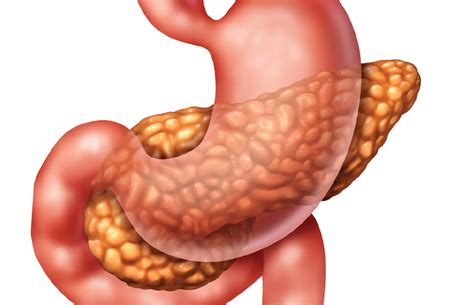 Pancreatitis Signs And Symptoms This Quarterly