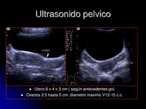 Ultrasonido Pelvico Imagui