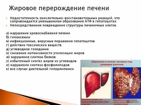 Жировое изменение печени диета Патофизиология печени - презентация онлайн Патофизиология печени - презентация онлайн Жировое изменение печени диета