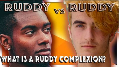 What Is A Ruddy Complexion 2021 Youtube