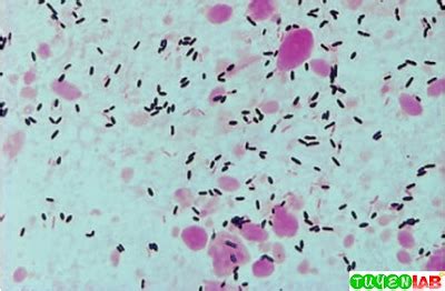 This pathogen is the only gram positive bacterium that produces endotoxin. Microbiology Atlas of Direct examination in gram ...