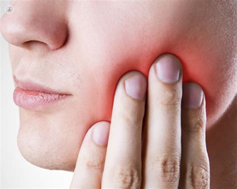 An Experts Guide To Salivary Gland Surgery