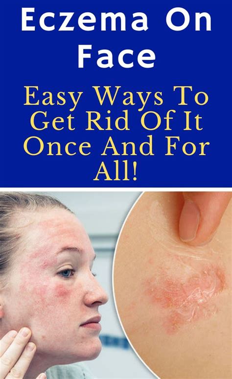 Eczema On Face Easy Ways To Get Rid Of It Once And For All Eczema Soothe Inflamed Skin