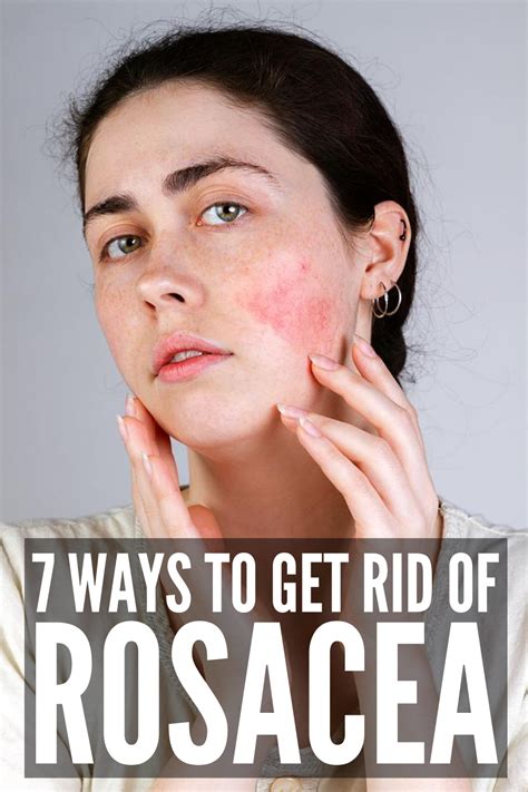 How To Get Rid Of Rosacea 7 Rosacea Remedies That Work Red Face