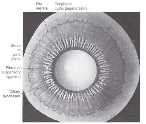 Posterior View Of The Ciliary Body Showing Ciliary