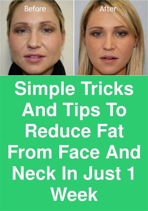 Pin On Lose Face Fat