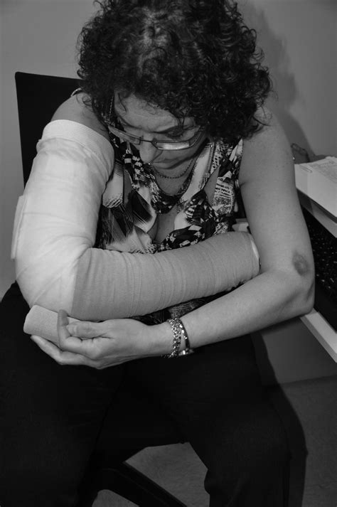 A Woman Bandaging Her Arm Using Multilayer Lymphedema Bandages
