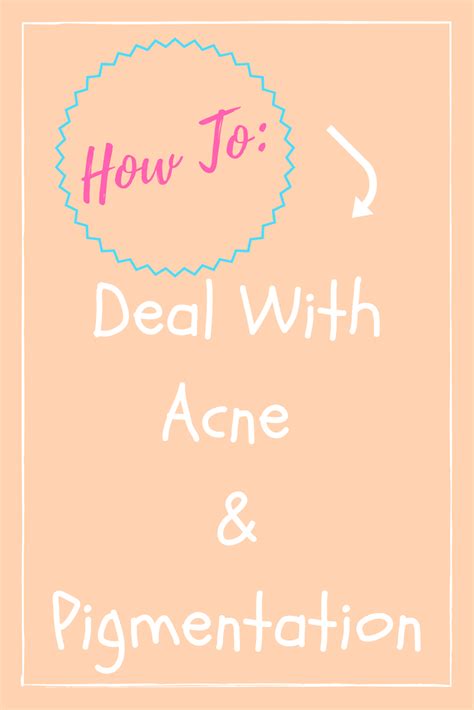 How To 3 Major Tips To Deal With Acne And Pigmentation Acne Skin