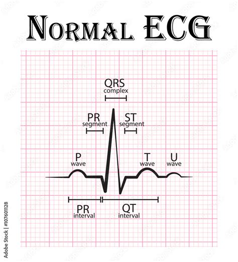 Vetor Do Stock Normal Ecg Electrocardiogram P Wave Pr Segment