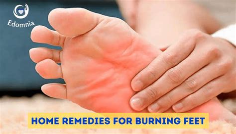 13 Effective Home Remedies For Burning Feet 2023 Edomnia