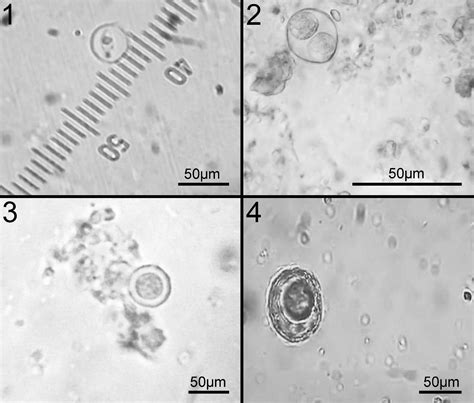 A Comparative Study Of Some Intestinal Parasites In Fecal Samples Of