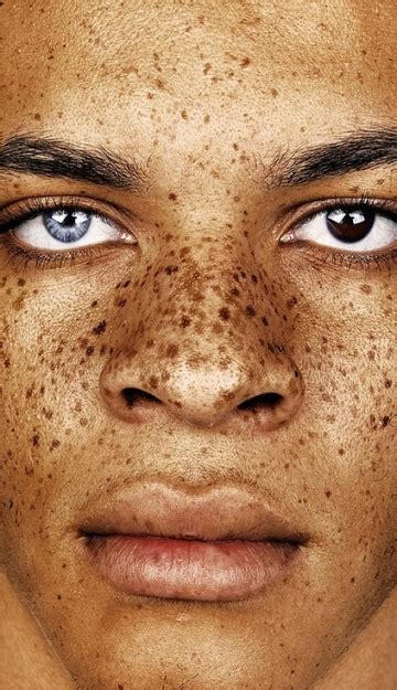 Assuming that there is an evolutionary advantage of attracting a genetically compatible mate, then. Why Do We Have Freckles On Our Face? - Frolicious ...