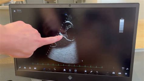 Cardiac Ultrasound Hand And Probe Positioning Youtube