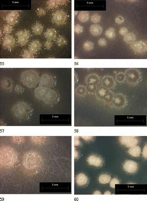 Calcifying Bacteria Colonies Of Six Different Strains Of Bacillus