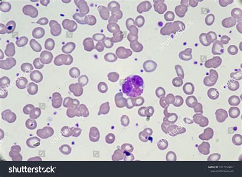 Eosinophil Blood Smear Stock Photo Edit Now 1017850867