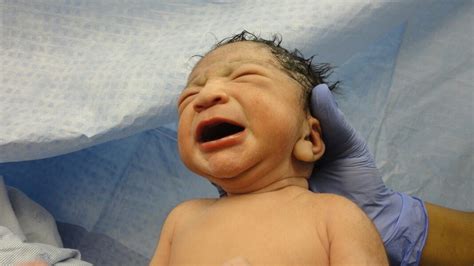 A Baby Babe Born With Double Penis And Two Scrotums In Egypt Newsblare