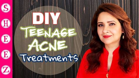 Teen Acne Acne Causes And Treatments For Teenage Boys And Girls Youtube