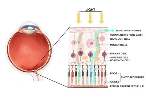 Retina Gene Vision