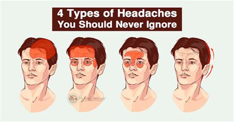 Be Healthy All 4 Types Of Headaches You Should Never Ignore
