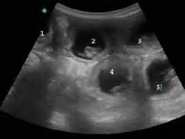 It will also be possible to work out the baby's due date, which is why an 8 week ultrasound is often called a dating scan. FREE PREGNANCY SCAN WITH OUR STUD NEIBULL SHOWDOGS ...