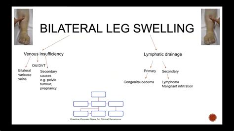 Concept Maps Approach To A Patient With Leg Swelling Youtube