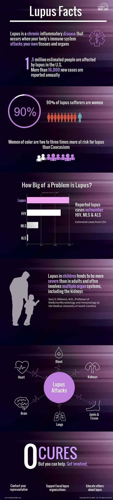 Lupus Facts Infographic