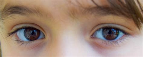 Learn about all the causes and treatments for cdc: Kid's eyes by Кристина Иванова - Voubs.com