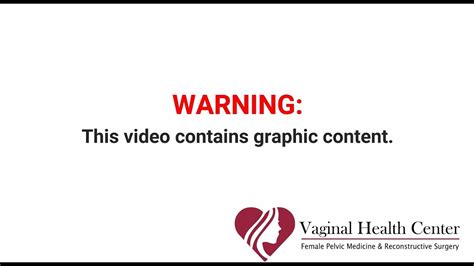 Before And After Of Vaginal Rejuvenation With Labiaplasty And Vaginoplasty Youtube
