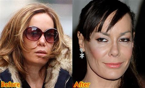 Years of cocaine abuse in the late 90s took its toll on tara's nose, leaving it on the brink of collapse. Tara Palmer Tomkinson Plastic Surgery Before And After ...