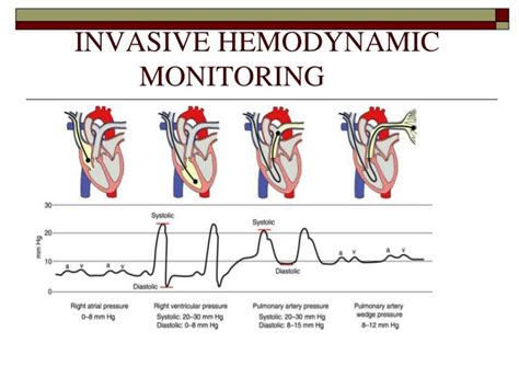 Ppt Invasive Hemodynamic Monitoring Powerpoint Presentation Id6333249