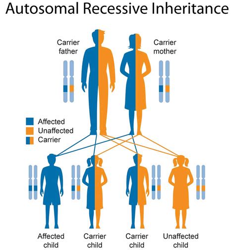 Dominant which of the statements is true? Waardenburg syndrome causes, types, symptoms, diagnosis ...