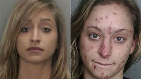 Faces Of Crystal Meth Shocking Before And After Pictures Reveal Damage