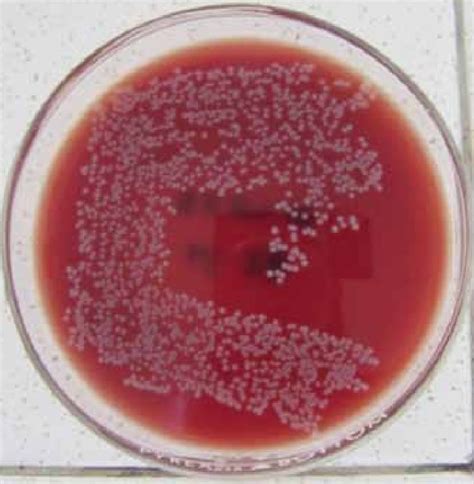 Prestigio General Conversacional Staphylococcus Intermedius En Perros