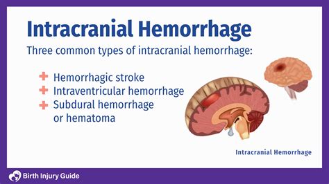 Intracranial Hemorrhage In Babies Birth Injury Guide