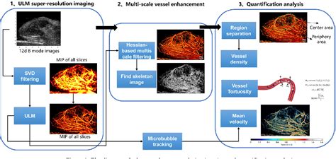 Figure 1 From Ultrasound Super Resolution Imaging Enables