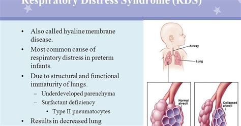 Introduction Respiratory Distress Syndrome Of The Newborns RDS Also