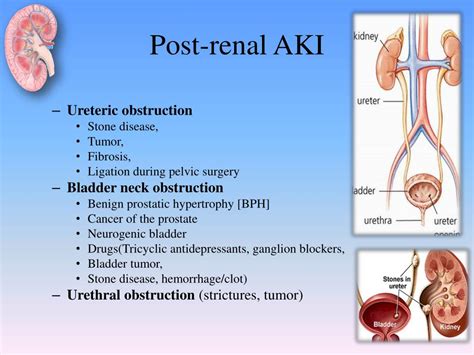 Ppt Approach To Acute Kidney Injury Powerpoint Presentation Free