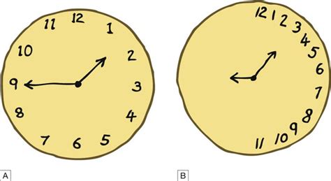 It is important that this test is done in the patient's first language to be accurate. Stroke disease | Basicmedical Key